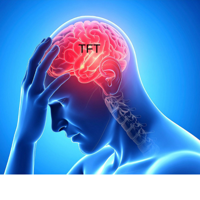 מה זה טראנס תראפי